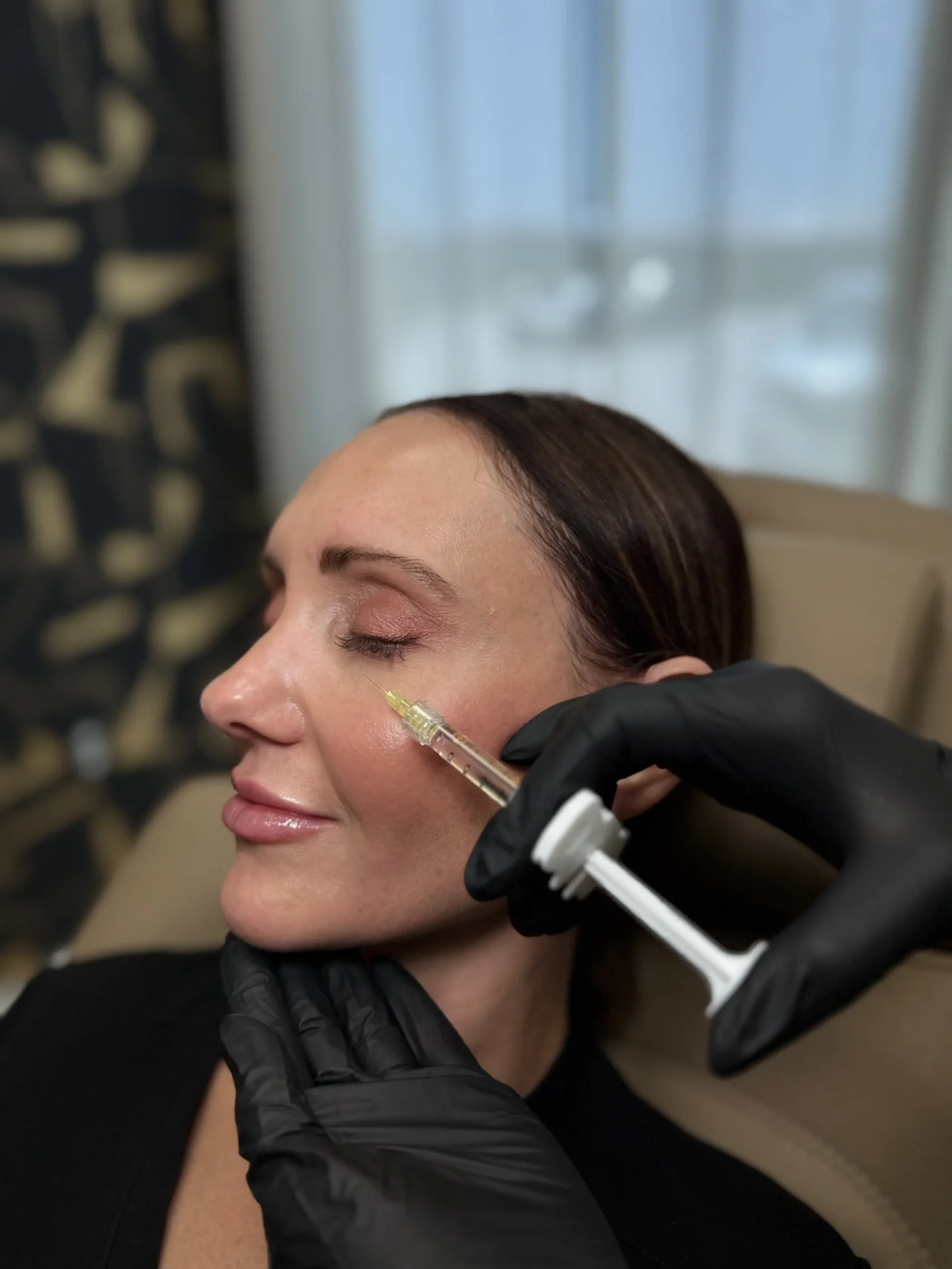 Belotero - the sculptry