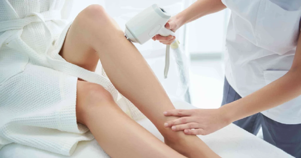 Woman receiving laser hair removal on lower legs with handheld device in Lake Charles, LA.