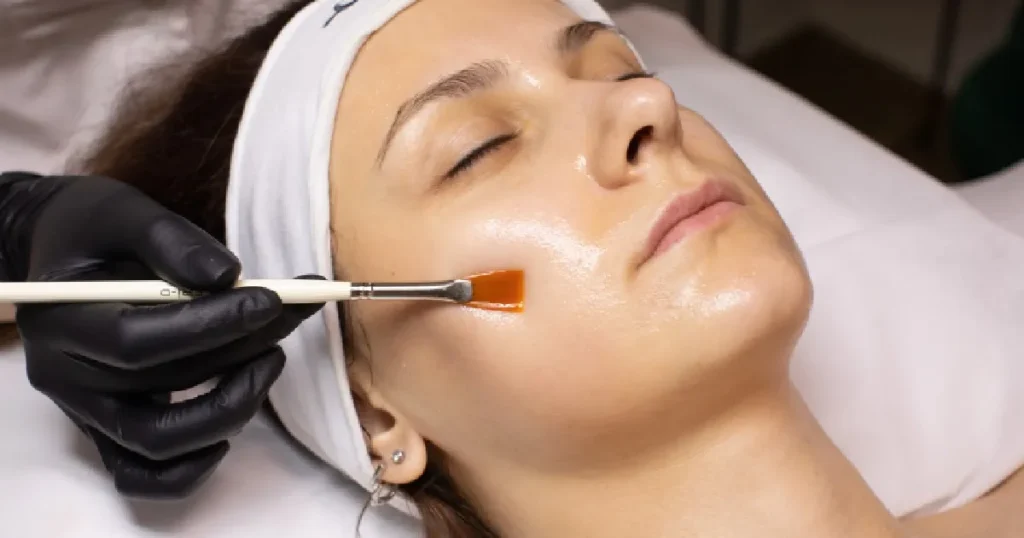 Women receiving Chemical Peels in Lake Charles, LA