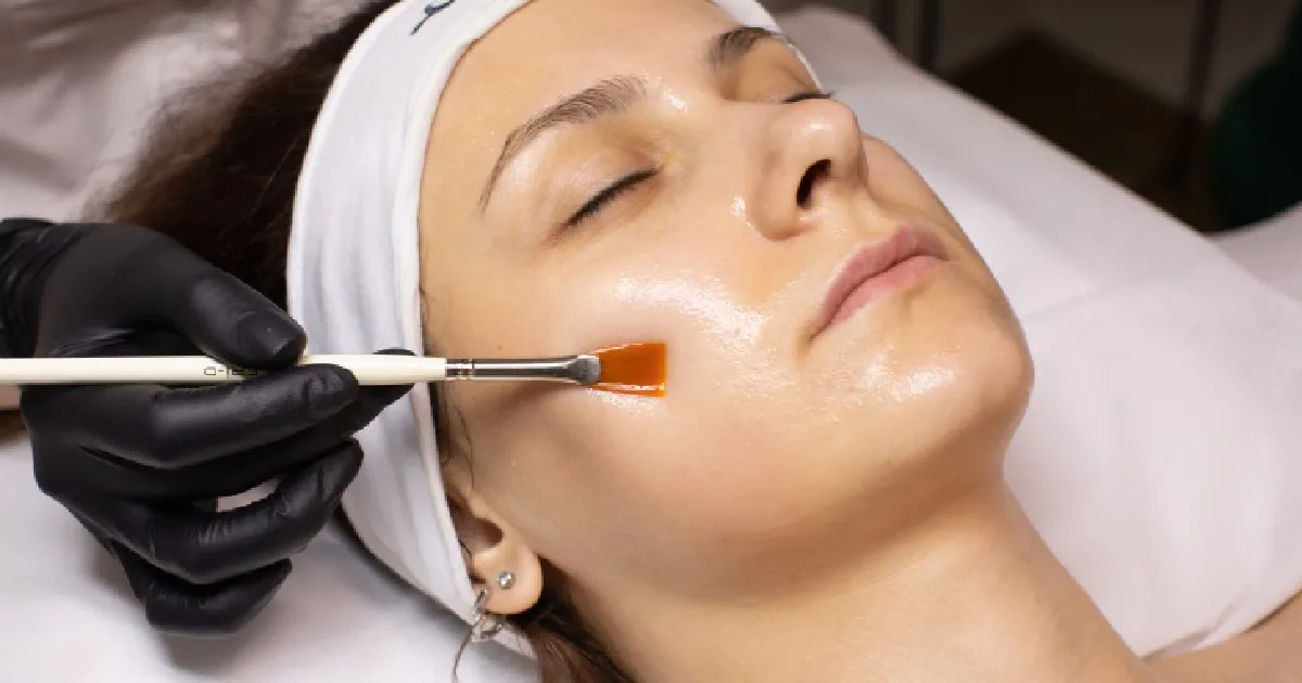 Women receiving Chemical Peels in Lake Charles, LA